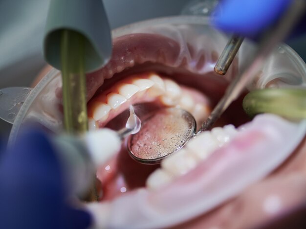Close-up of patient receiving dental treatment