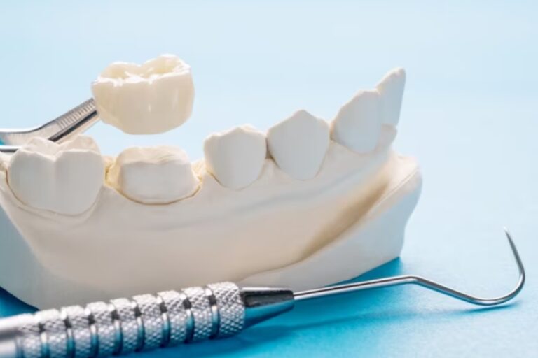 Close-up of dental prosthetics